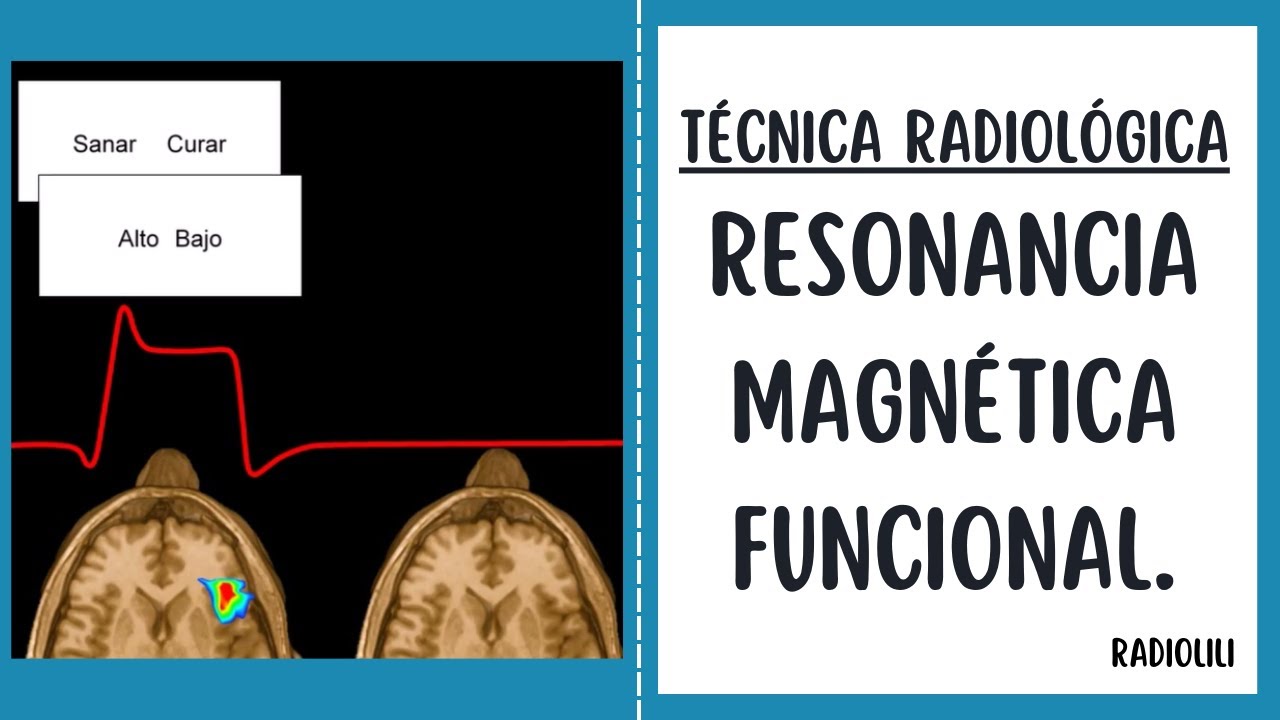Resonancia Magnética funcional: Técnica Radiológica.