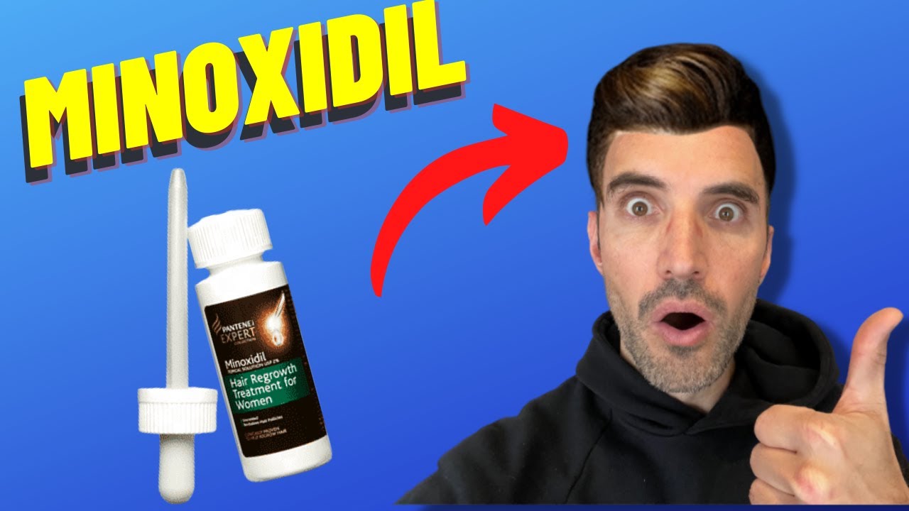 Le Minoxidil améliore t'il votre greffe de cheveux ?