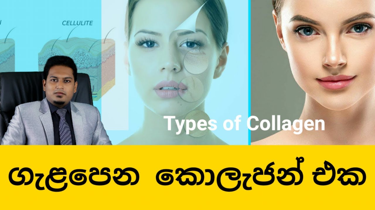 ඔබට ගැළපෙන Collagen එක මොකක්ද? Types of Collagen  By Nutritionist Hiroshan Jayaranga
