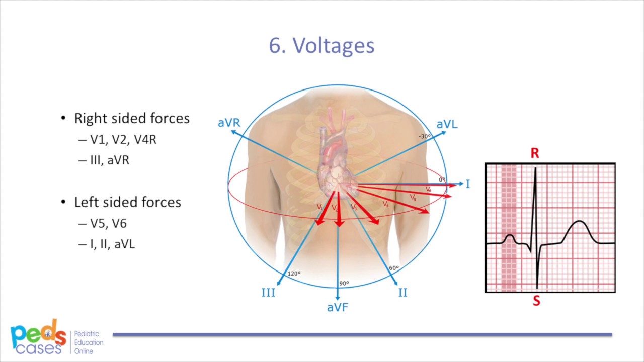 Approach to Pediatric ECGs (Part 2/2)