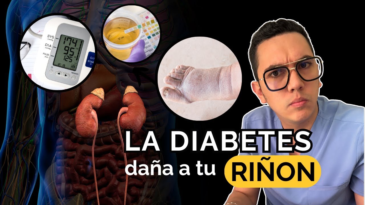 La diabetes te daña el riñón, haz esto para evitarlo | Dr. William Guerrero