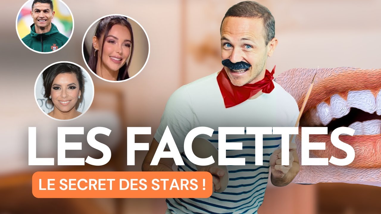 Les facettes dentaires : avant/après, prix et techniques...