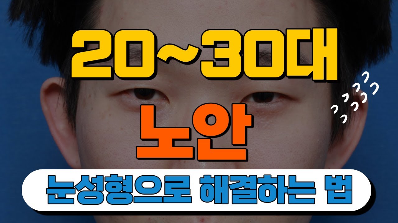[모티브 성형외과]  20대-30대 노안, 눈성형으로 해결하는법! #동안 눈의 조건 #비절개눈매교정#절개눈매교정#쌍꺼풀재수술