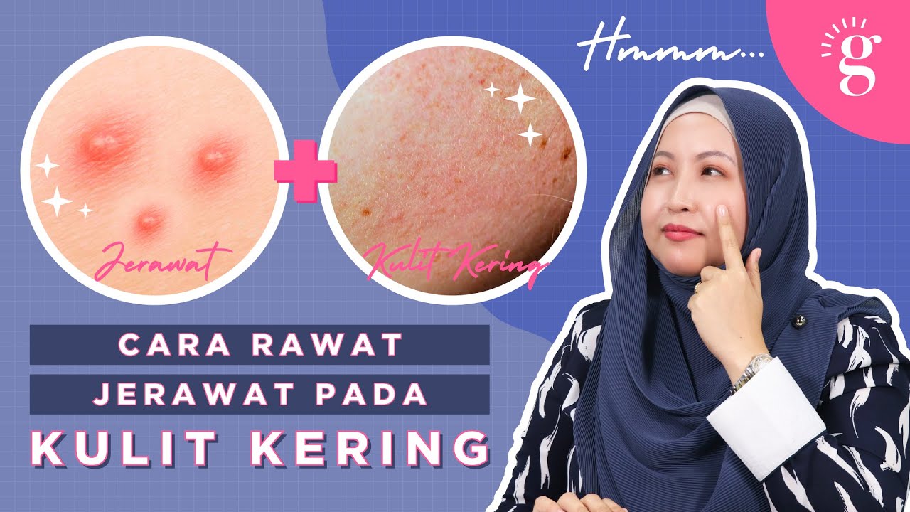 Kulit Kering Tetapi Berjerawat? Ini Puncanya!