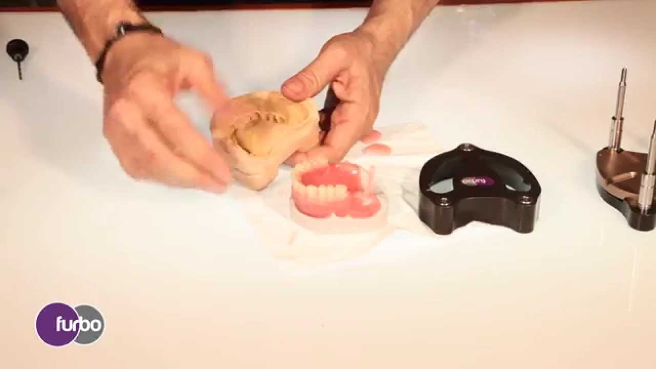 RIBASATURA PROTESI | CON VERTYSYSTEM®