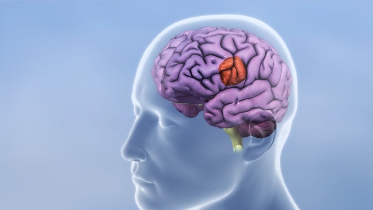 Breakthrough in the fight against glioblastoma