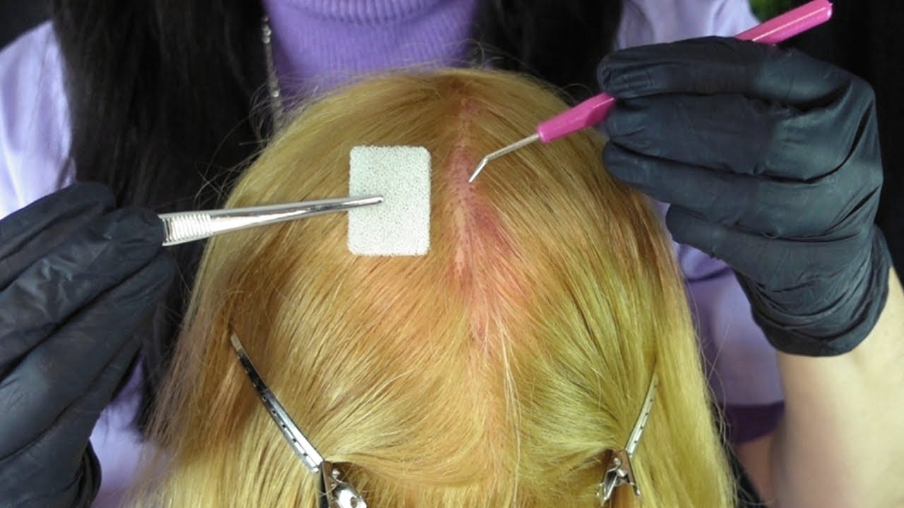 ASMR Bleach Fail ~ Scalp Check & First Aid Treatment (Whispered)