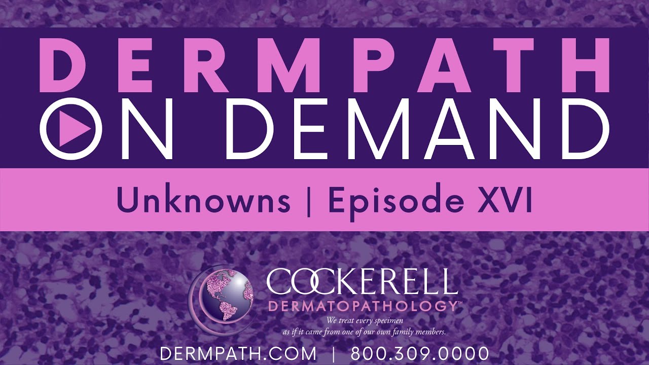 Unknowns | Episode XVI