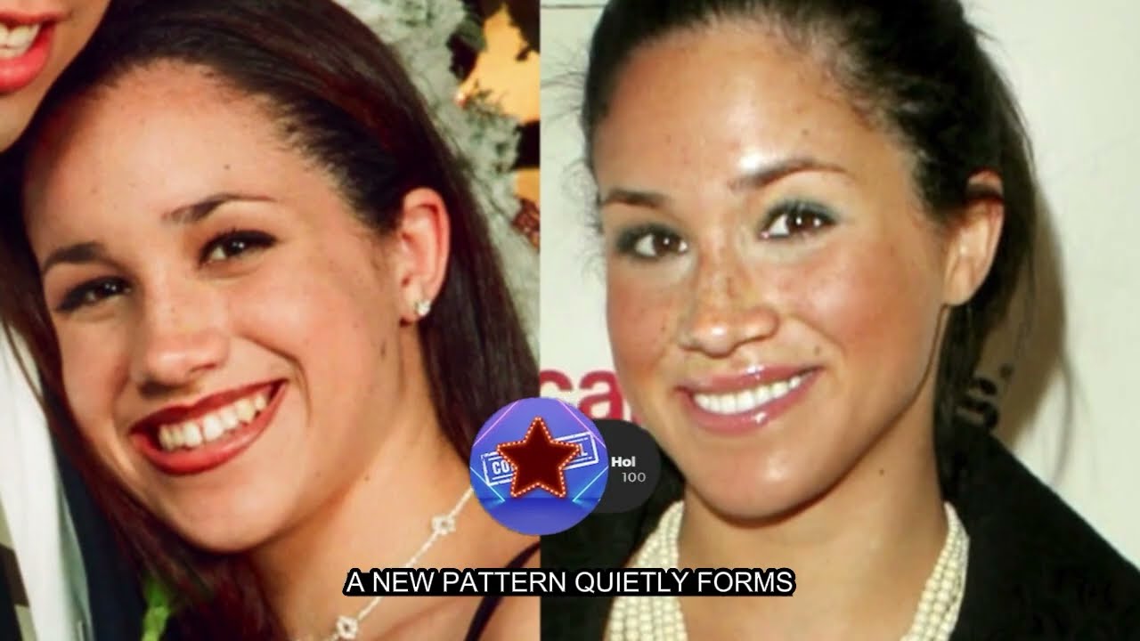 Candace Owens DESTROYS Meghan Markle After Plastic Surgeries Are Revealed