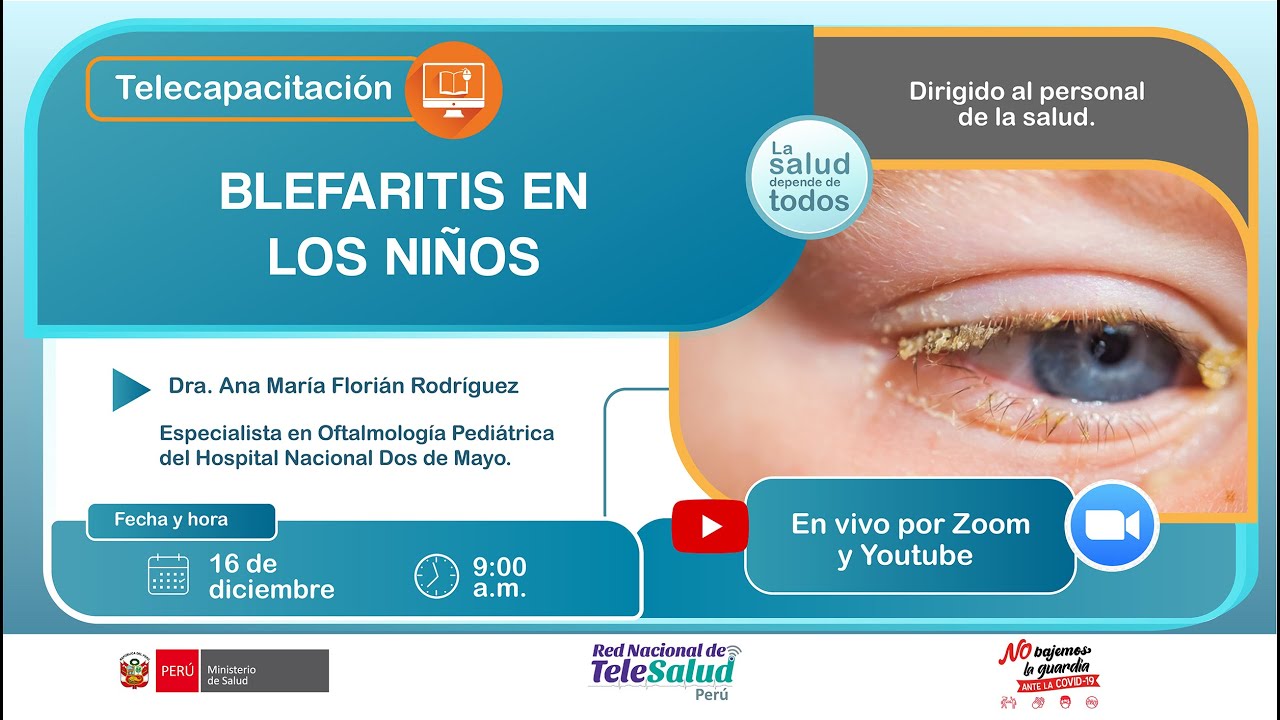 BLEFARITIS EN NIÑOS