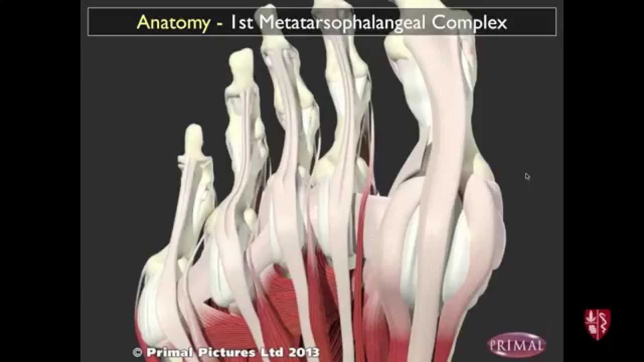Injuries of the Hallux MTP: Turf Toe