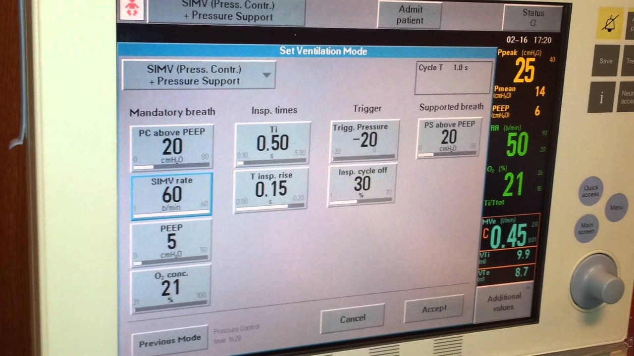 Neonatal Mechanical Ventilation CBO