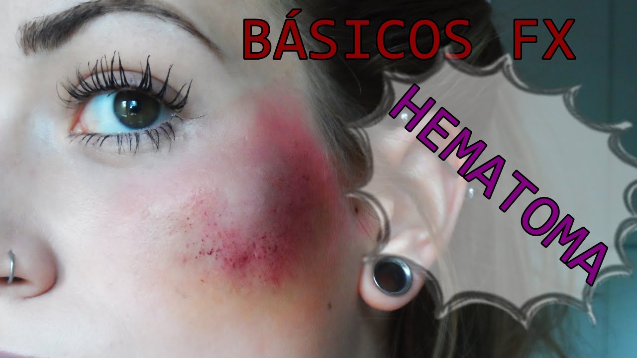 HEMATOMA FX MAKEUP | Bloody Betty