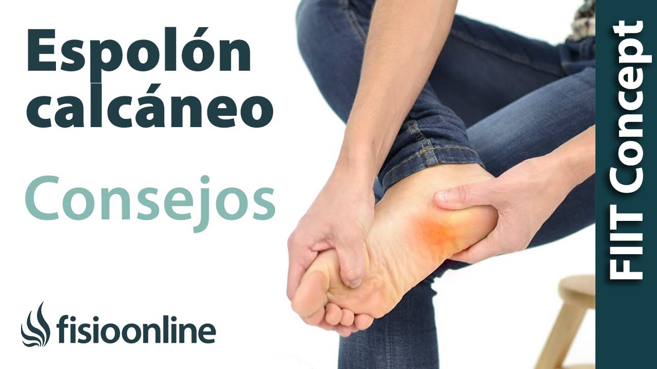 3 cosas que debes saber para curar el espol&oacute;n calc&aacute;neo