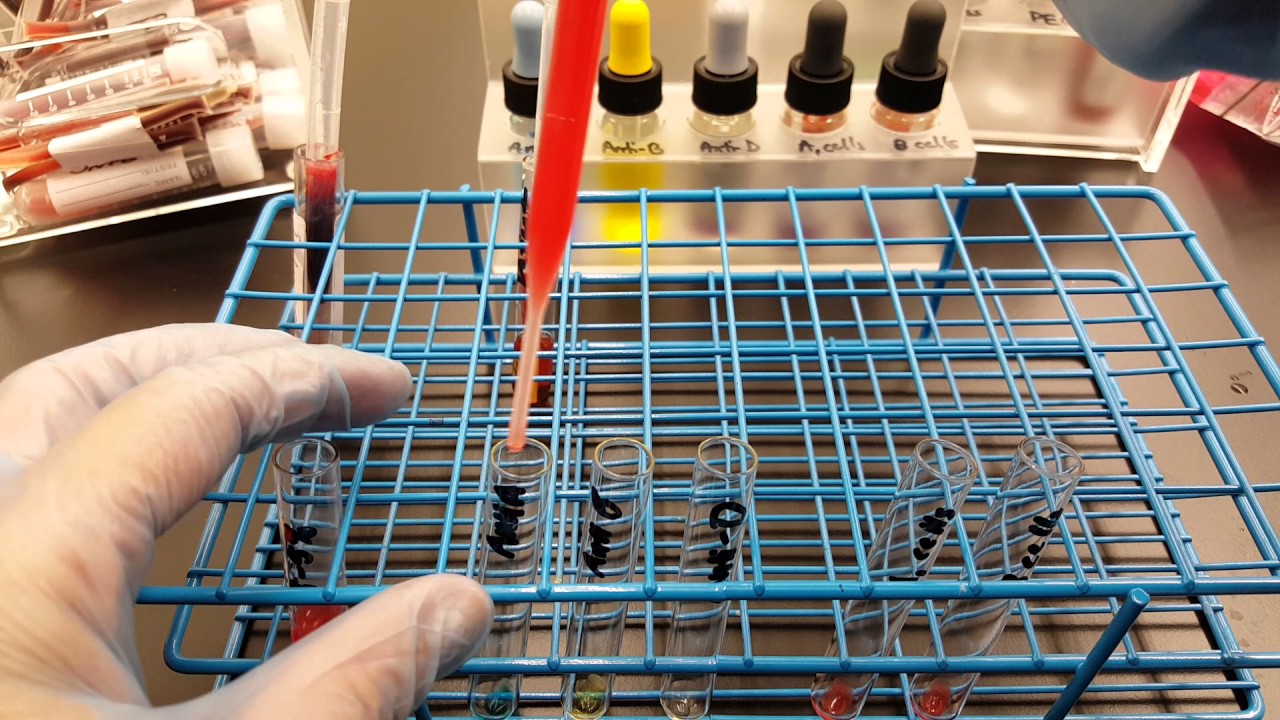 Blood Banking: ABO&D testing Part 1