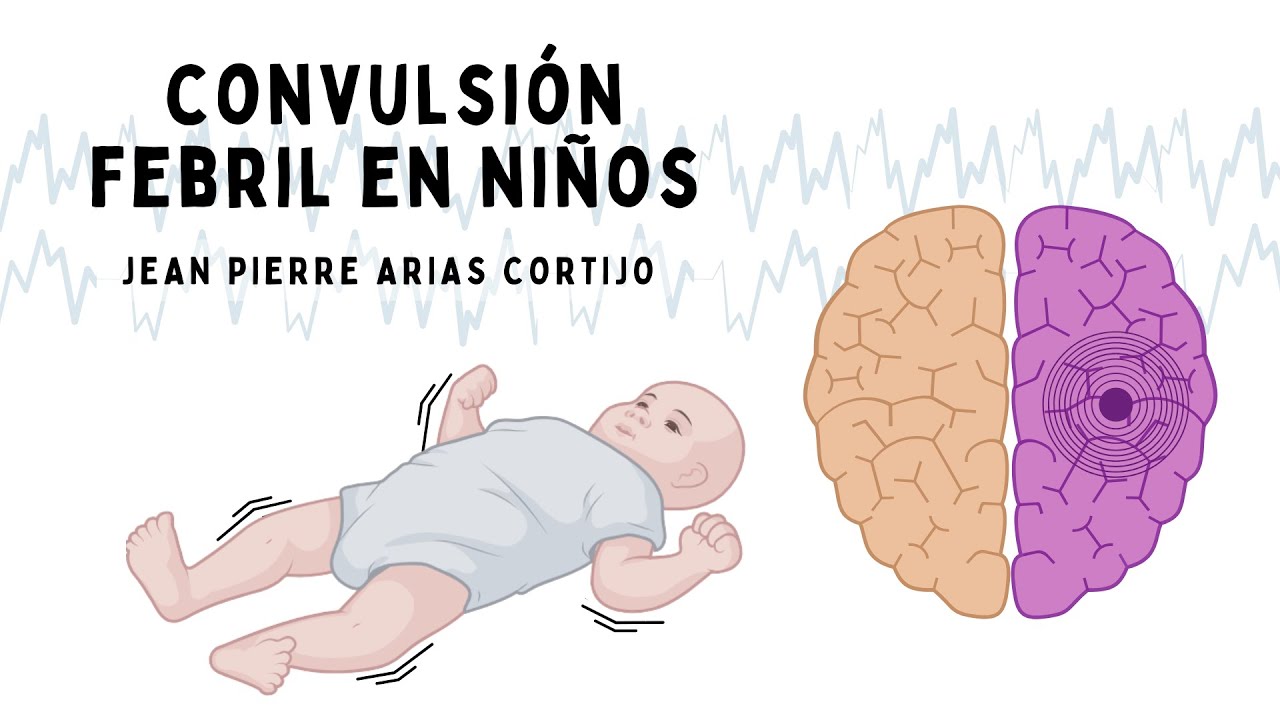 Convulsión febril en niños: etiología, fisiopatología, diagnóstico y tratamiento