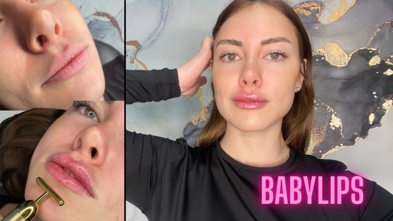 Babylips  Dudak Vitamin Dolgusu Denedim | Tüm Süreç