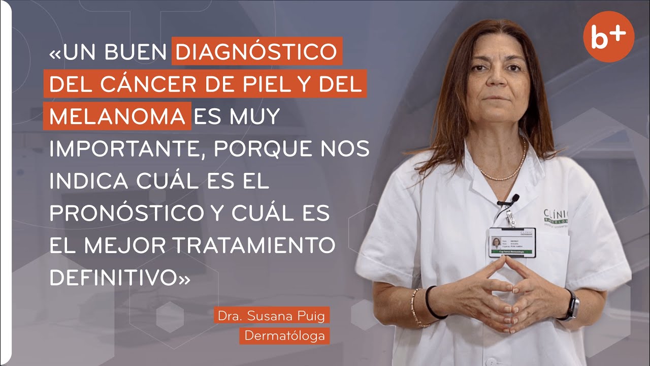 CÁNCER DE PIEL y MELANOMA: Incidencia, causas, diagnóstico y tratamiento | Dra. Susana Puig