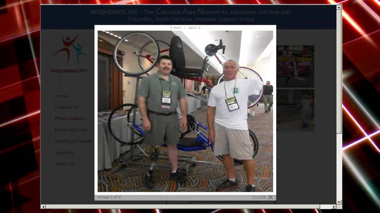 AmputeesCAN: Support group for Columbia amputees