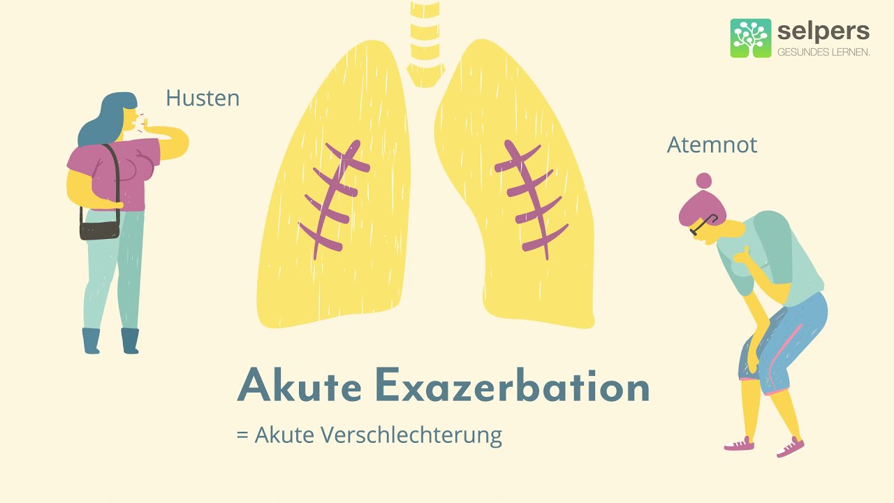 Lungenfibrose - Akute Verschlechterung (Experte erkl&auml;rt)
