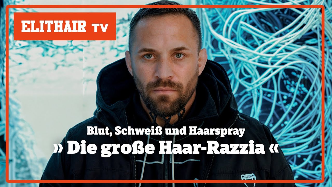 Hinter den Kulissen der Haartransplantation: Der Fall Christian Eckerlin in der Türkei