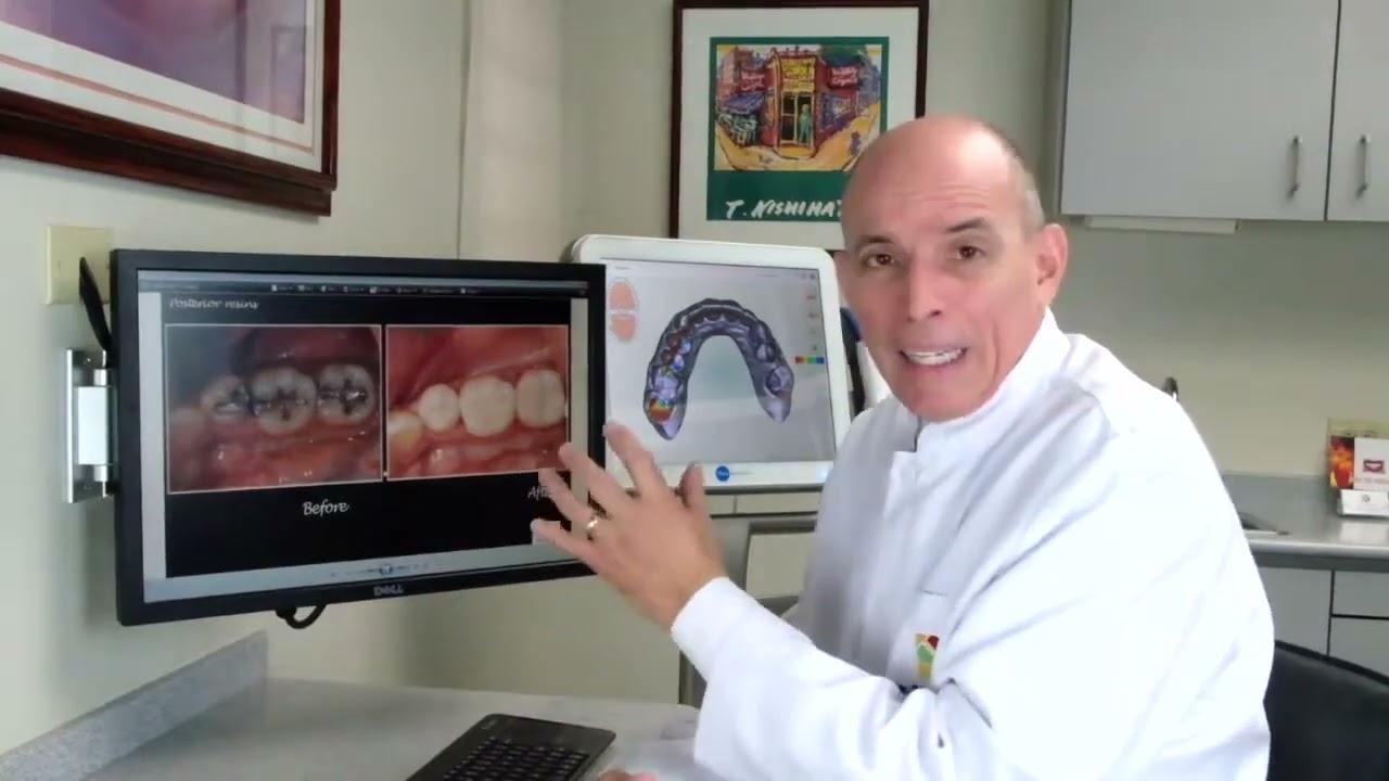 Materiales Color Diente (San Juan PR Dentist)
