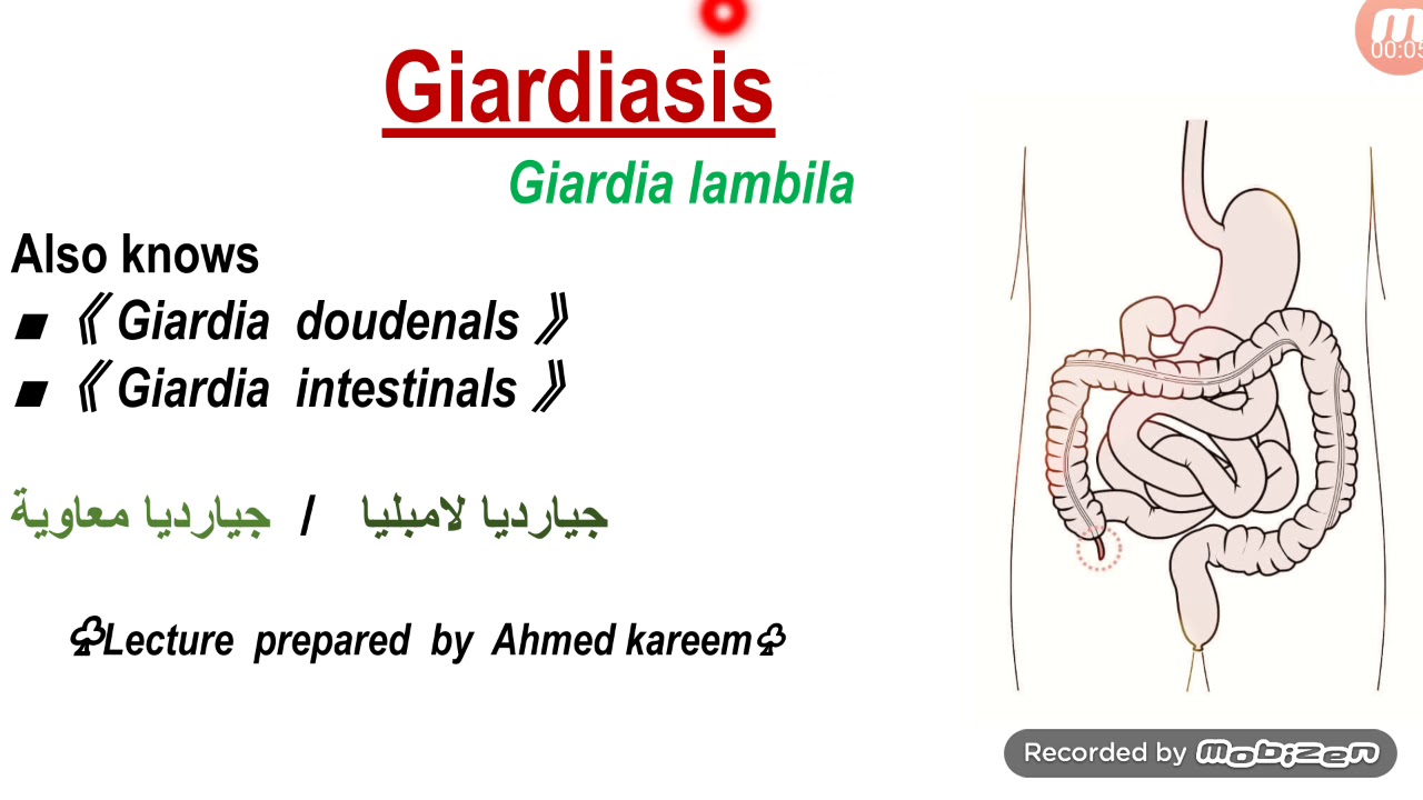 داء الجيارديات   Giardiasis