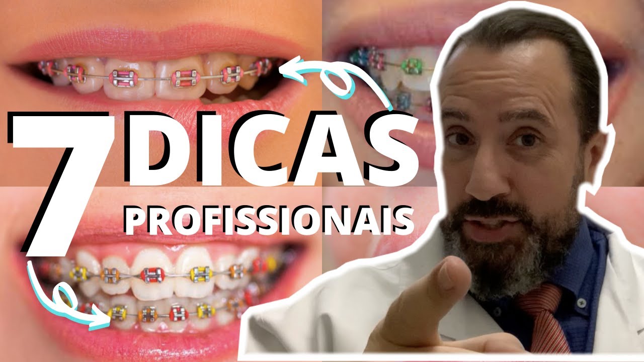 7 Dicas Profissionais Para Quem Usa Aparelho Ortodôntico