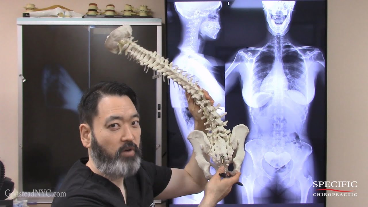 Gonstead Xray Analysis - Compound ilium, Heel lift, Sacral base angle