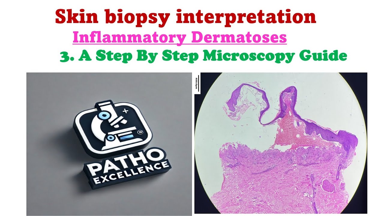 Skin Biopsy Interpretation | Inflammatory Dermatoses Microscopy Checklist and Guide | Episode 3