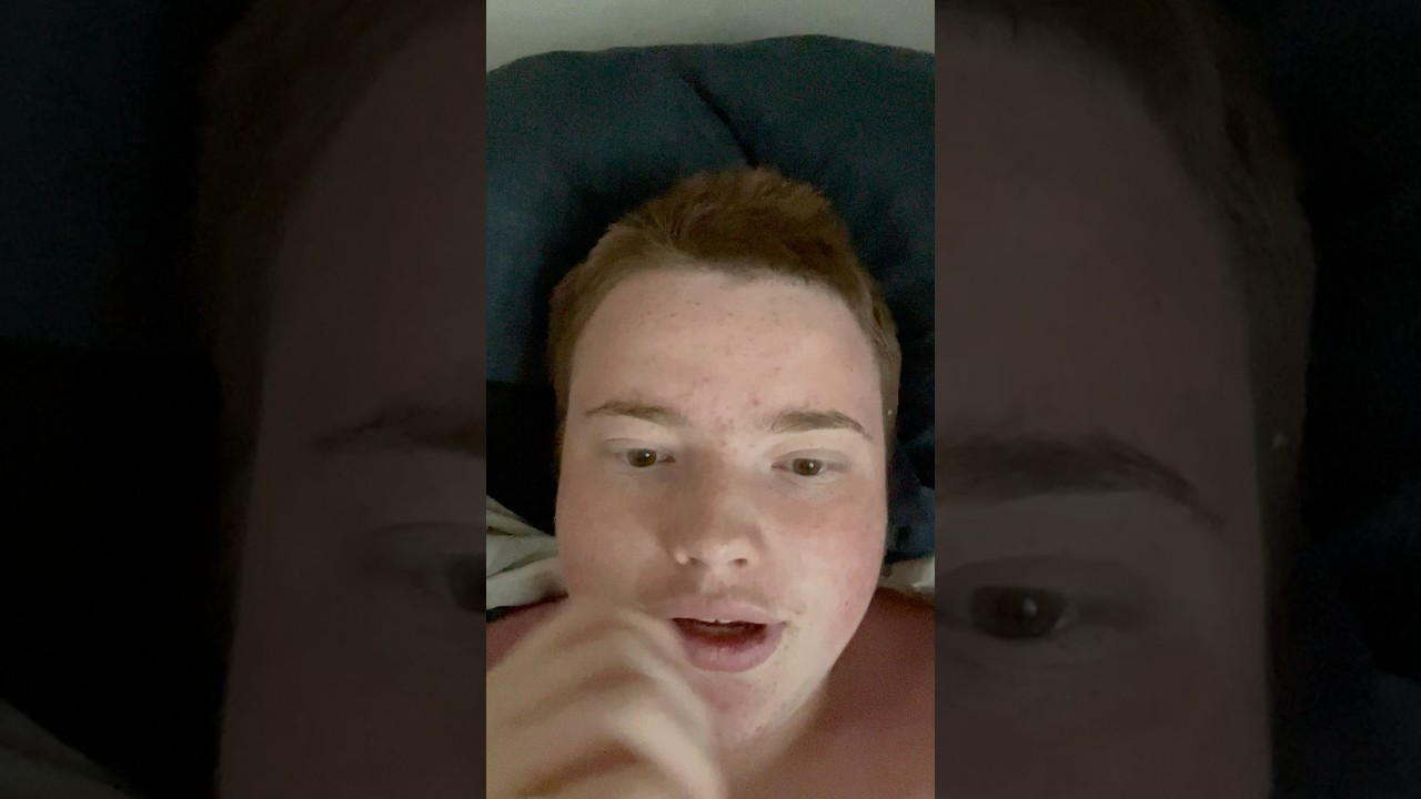 How I dealt with DEVILS ITCH sunburn