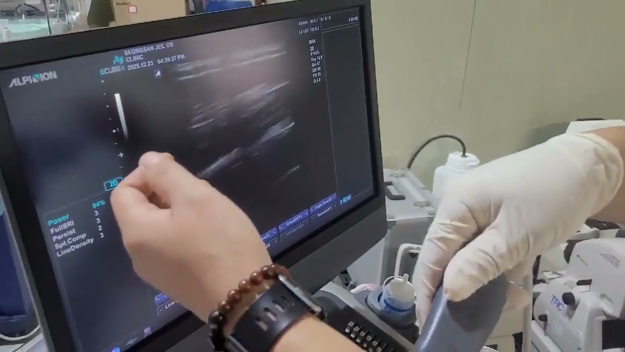 Alpinion Ecube9 Ultrasound - 2Probes Convex Linear For Sale