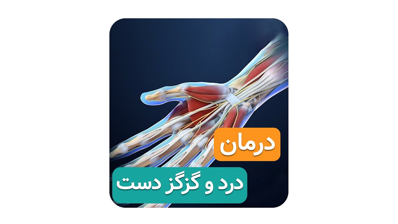 درمان درد و گزگز دست ( دکتر محمدرضا صادقی _ جراح ارتوپد تهران )