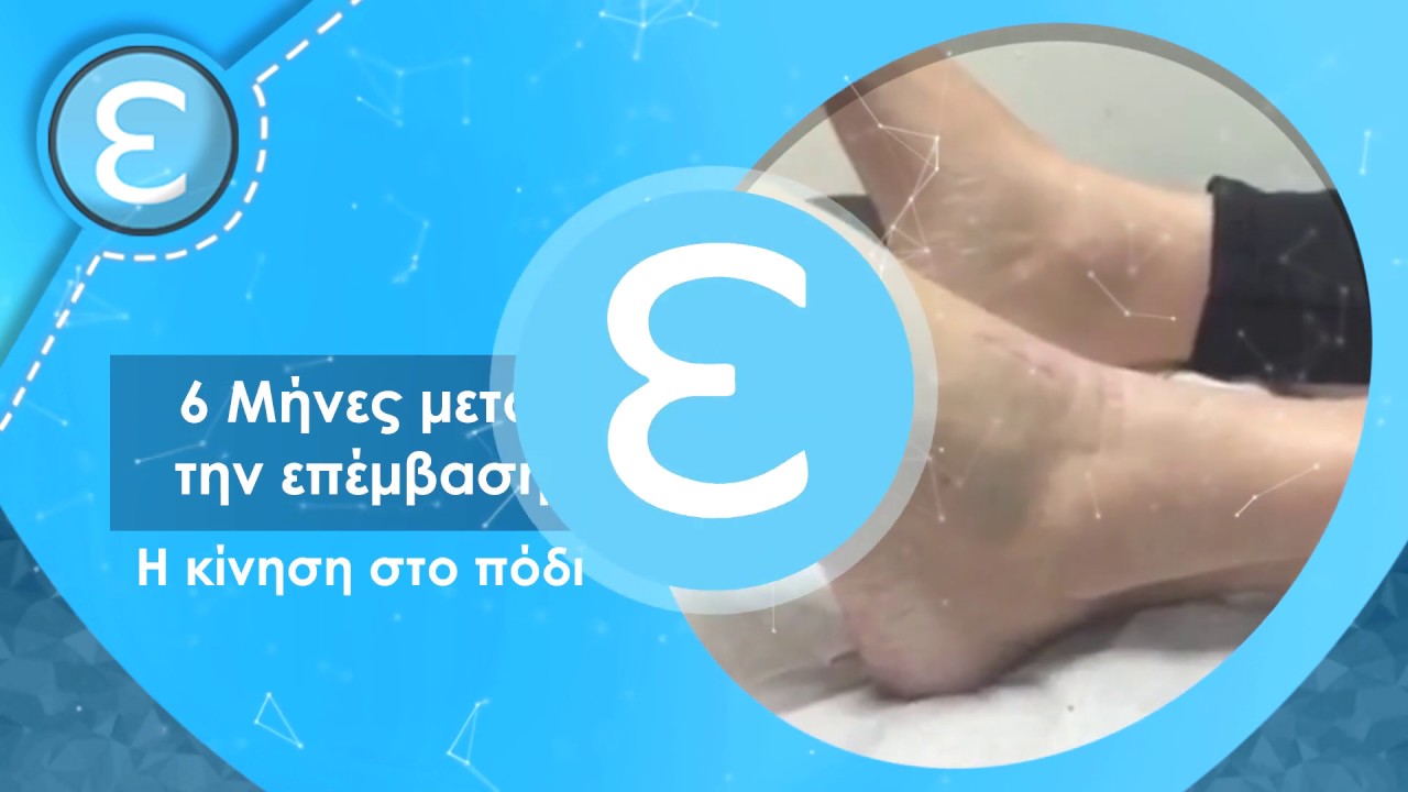 Ευάγγελος Ευάγγελου - Αρθρίτιδα Ποδοκνημικής
