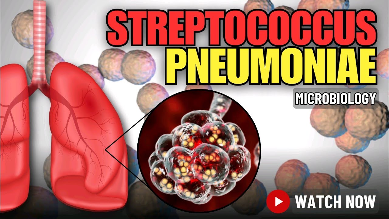 Streptococcus pneumoniae: Silent Killer Lurking in Your Nose - A Comprehensive Overview