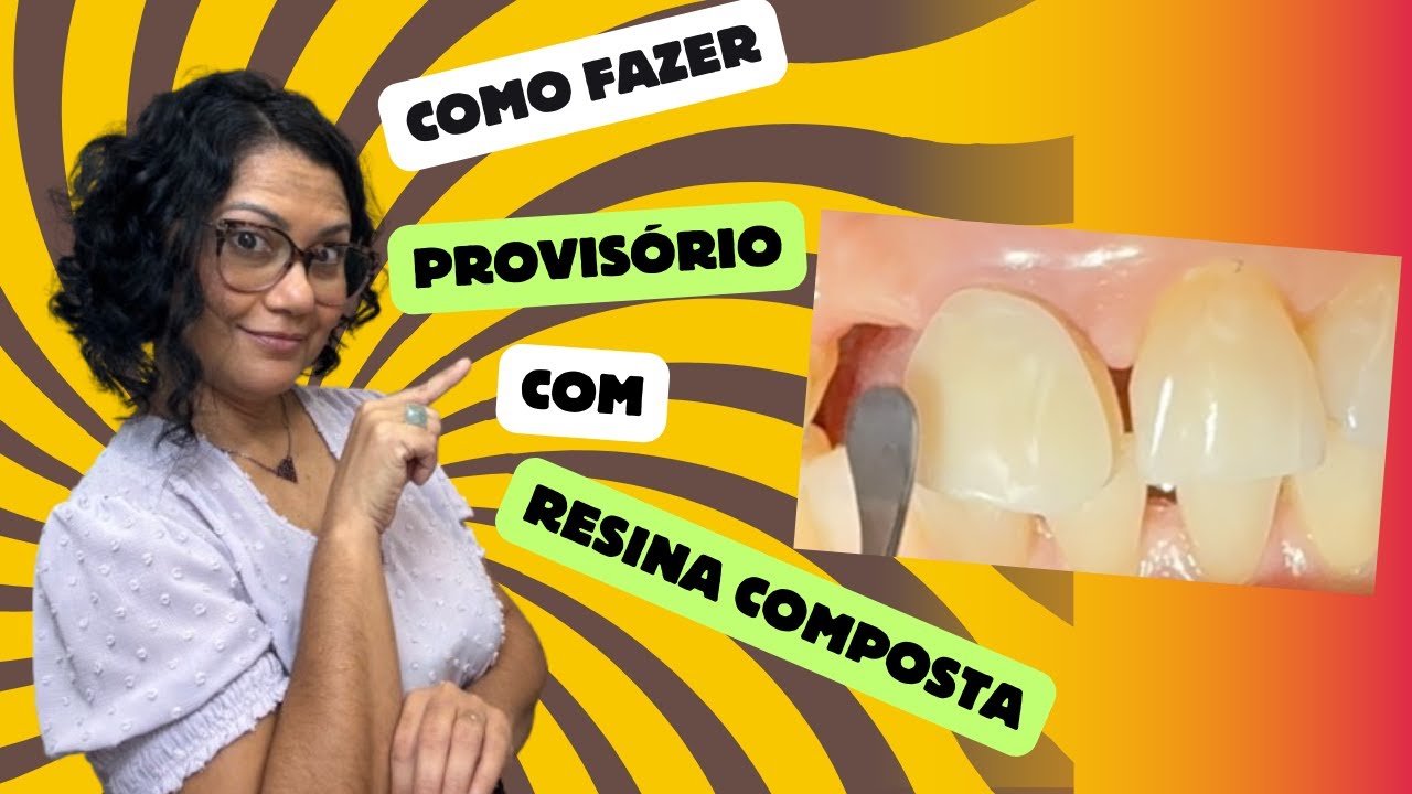 Provisório com Resina Composta