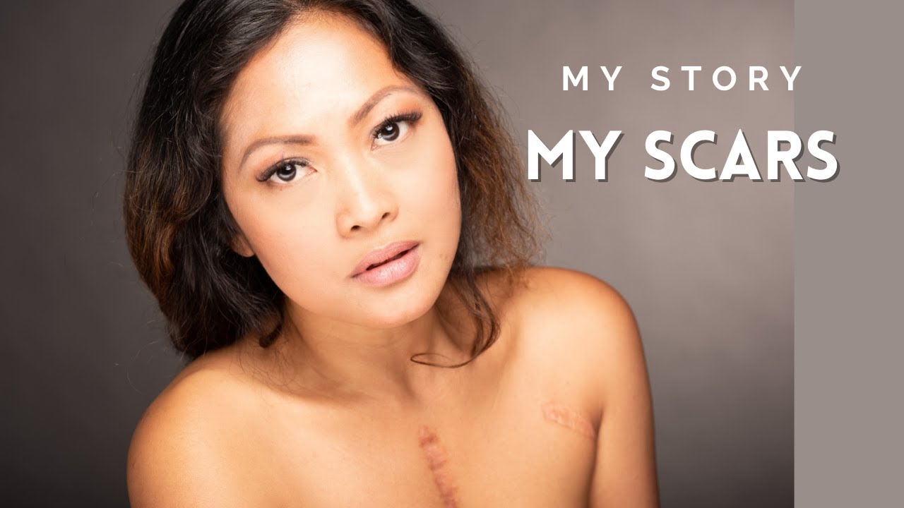 MY STORY MY SCARS / A JOURNEY OF A HEART PATIENT ( RISE UP COVER )