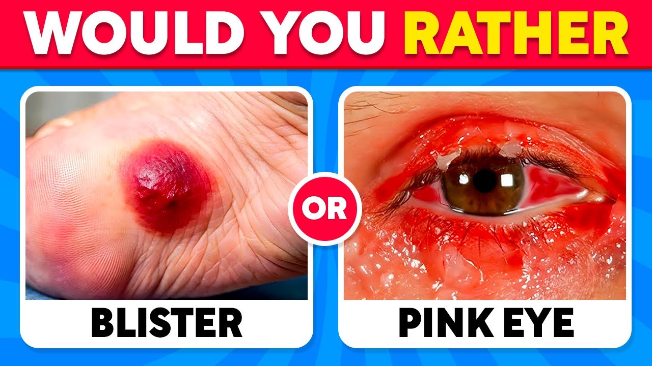 Would You Rather - 100 HARDEST Choices Ever! 🤔❓✅ Warning: EXTREME Edition