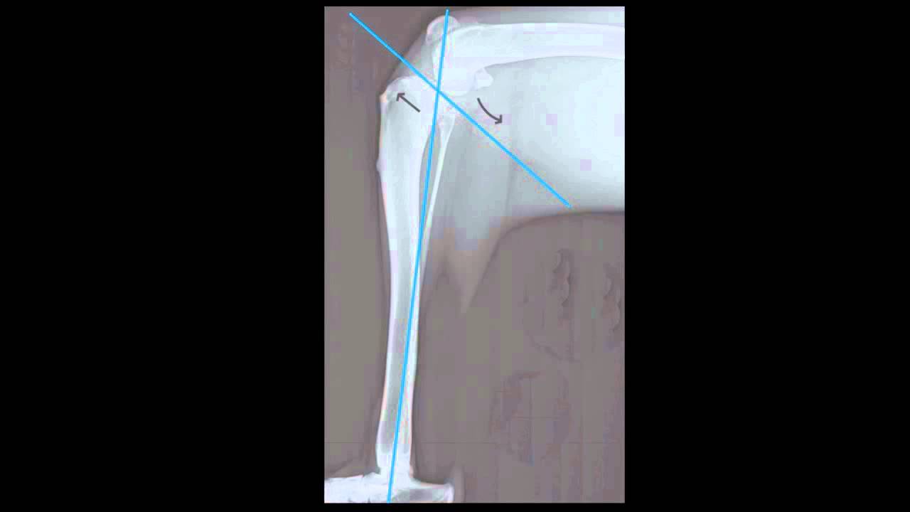 TPLO Surgery Animation Movie