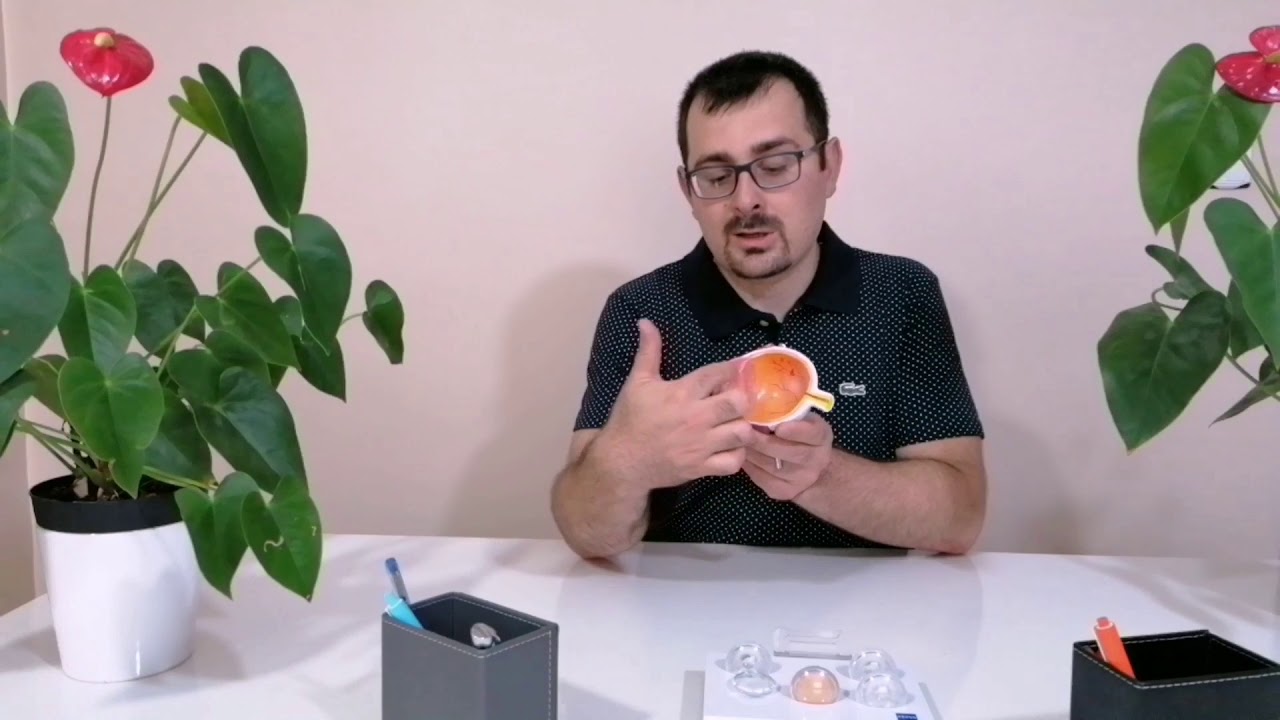 Gözde sinek uçuşması? Gözde sinek uçuşması nasıl geçer? Gözde sinek uçuşması neden olur?
