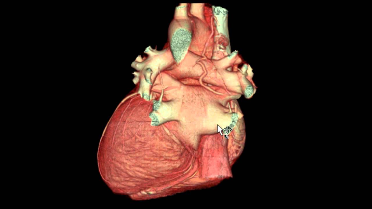 External Features of the Heart in 3D