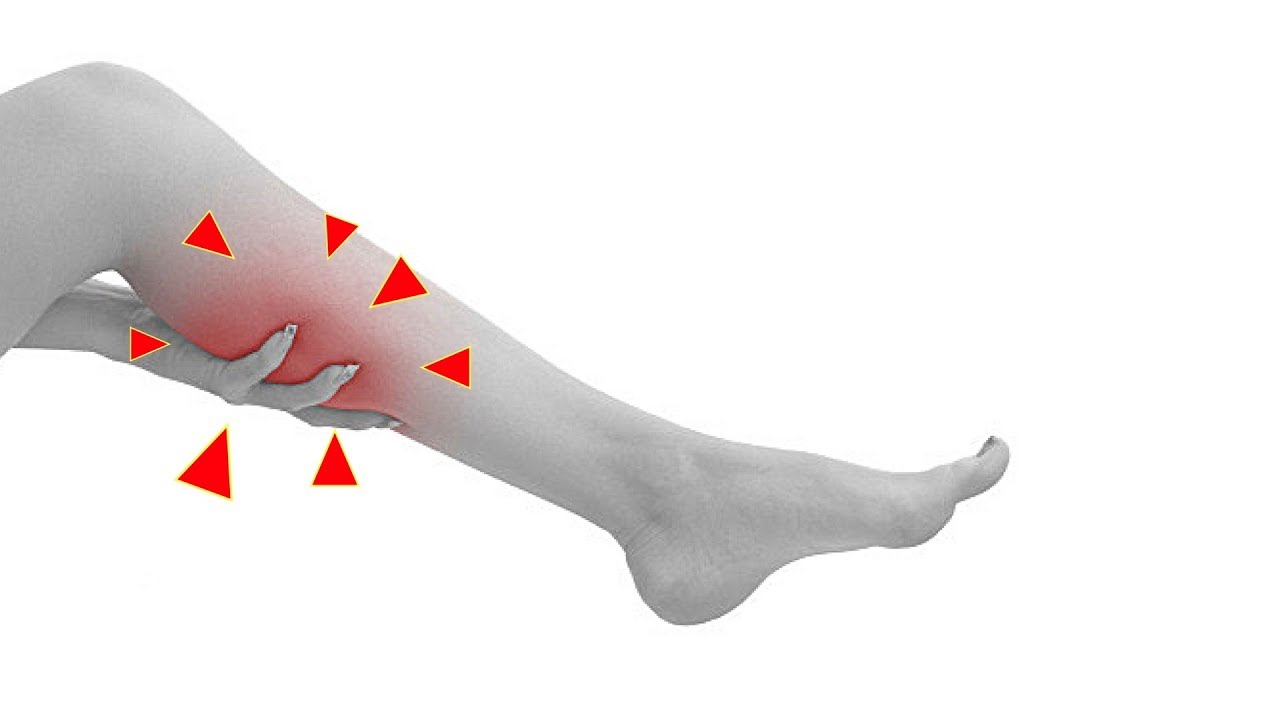 How to Deal with Annoying Night Calf Muscle Cramps NOW