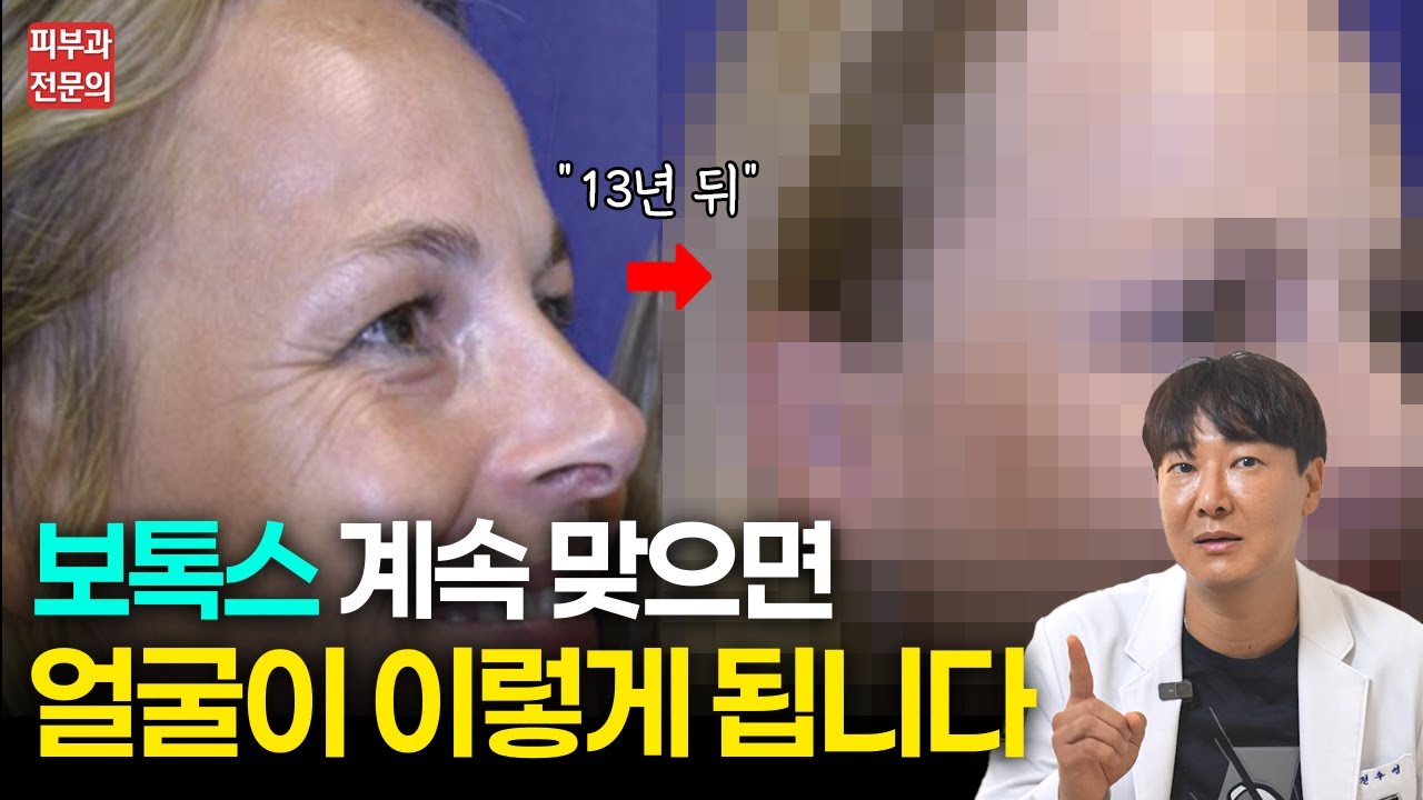 13년간 보톡스를 맞은 얼굴의 충격적인 결과 / 보톡스의 진실