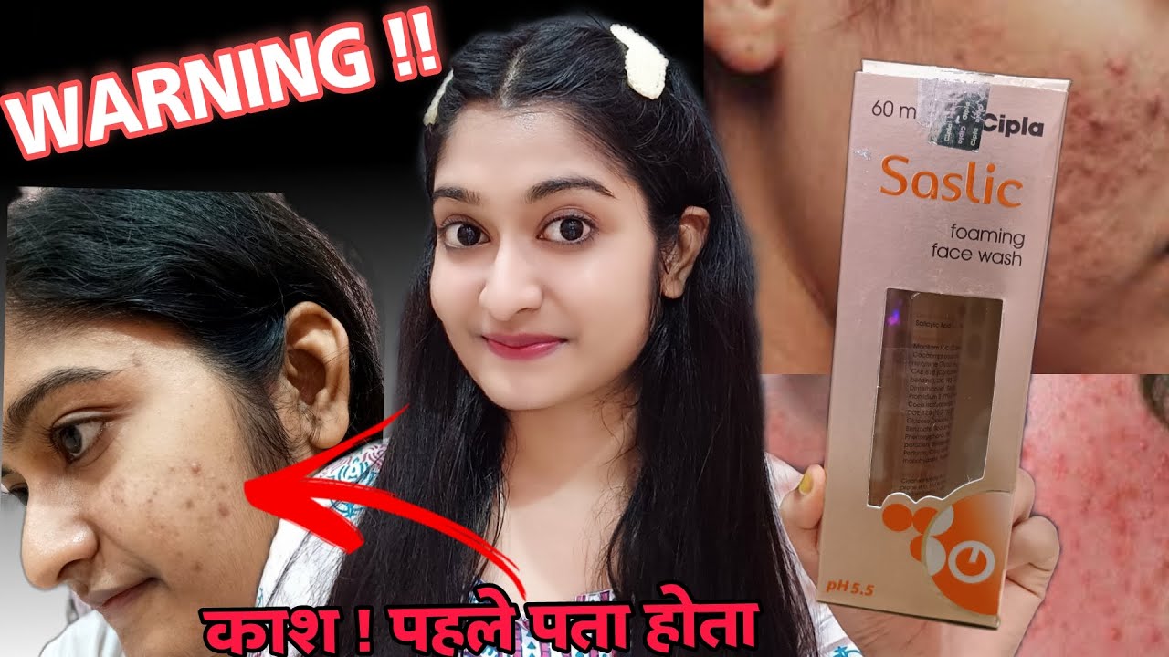 Saslic foaming facewash review | cipla saslic facewash for acne prone skin | indigenous beauty