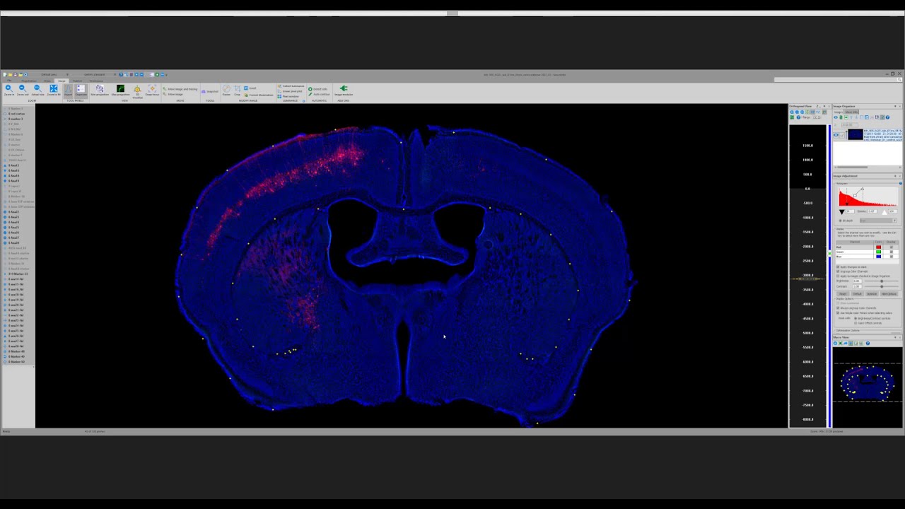 Webinar: Registering Mouse Brain Serial Sections to the Allen Atlas