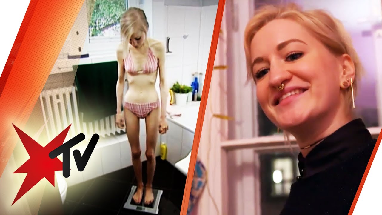 Hanna: Tagebuch einer Magers&uuml;chtigen | stern TV