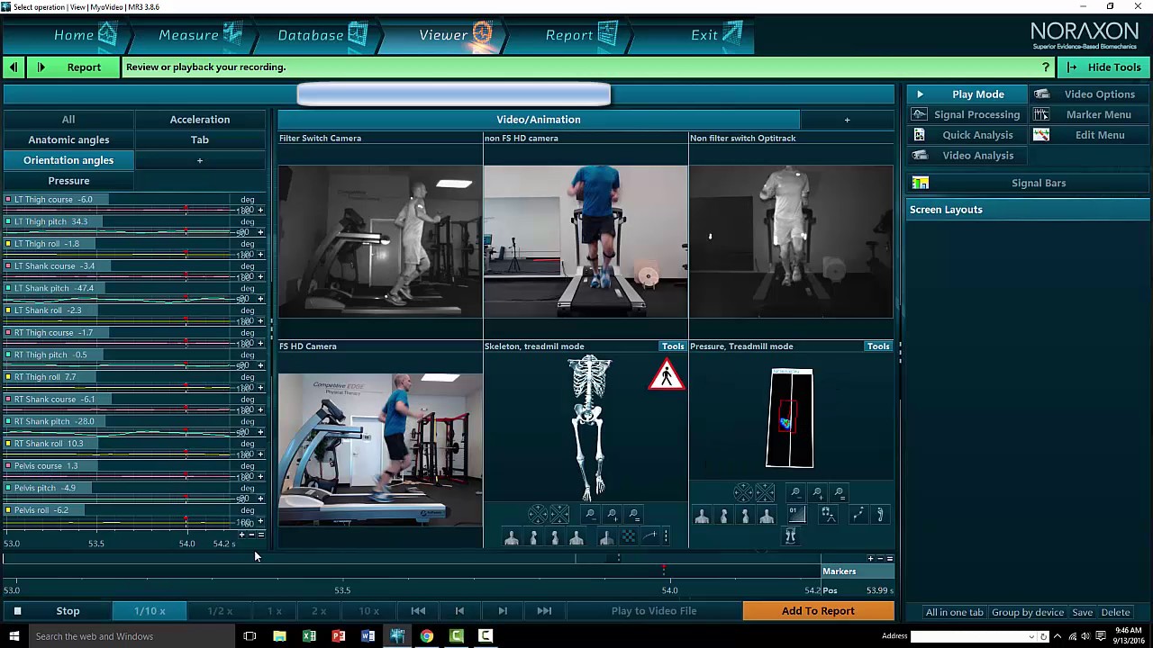 Running Gait Analysis: Competitive EDGE Physical Therapy Tutorial