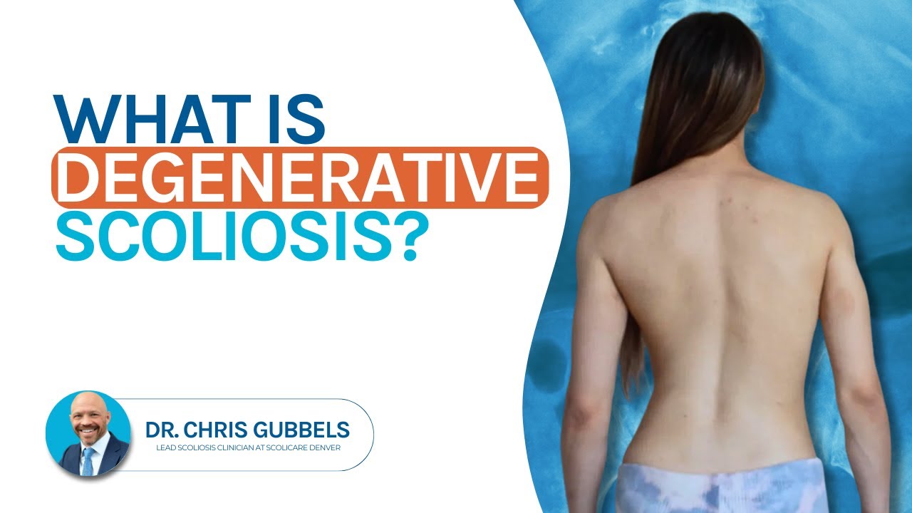 Degenerative Scoliosis Explained: Causes, Symptoms & Effective Treatments