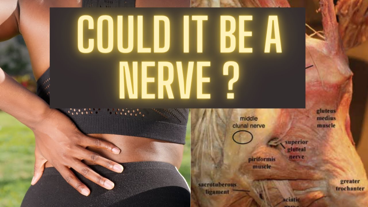 Cluneal Nerve Entrapment : A Little Known Cause For Back And Buttock Pain