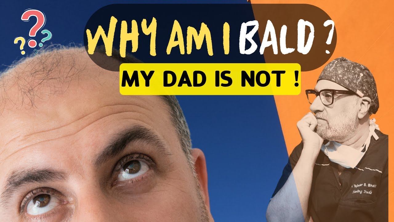 Hair Transplant in India if your DAD is not BALD!
